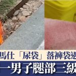 罗马仕“尿袋”|上海一男子放裤袋 自燃致腿部三级烧伤需植皮