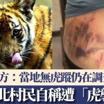 湖北村民晒背部伤痕称被老虎袭击 官方:当地无虎踪仍在调查