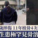 骨溶症|女生自15歲摔傷 11年植骨4次均溶解