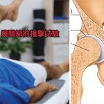 专栏 运动医道│髋关节病可进行前撞击试验