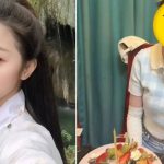 湖北女手机放枕边通宵叉电 爆炸烧伤7成皮肤毁容