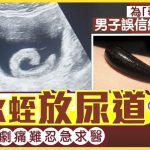 尿道塞水蛭︱23岁壮男为“奇特效果”做怪事 误信网上资讯最终痛到面容扭曲