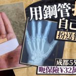 成都5外卖骑手钢管自折指骨 骗32万保险获刑6个月至两年