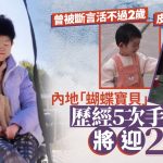 蝴蝶宝贝|河南女力抗病魔24年 历5次分指手术曾被预言活不过两岁