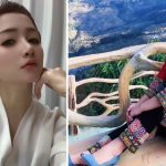 恙虫病︱39岁女博主遭咬后不治 临终前无法进食喉咙严重感染