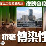 不是湿疹︱深圳一家五口患疥疮夜晚奇痕难入睡 医生警告:传染性极强