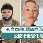 澳洲网红40岁生日送自己“新面孔” 携69岁母赴韩拉皮惹议