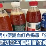 胰臟癌|深圳男小便變血紅色揭患「癌王」 需切除五個器官保命