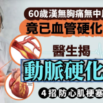 60岁汉无胸痛无中风竟已血管硬化?医生揭动脉硬化成因 4招防心肌梗塞