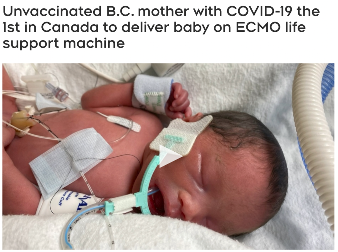 加拿大首例！女子使用ECMO生命支持诞下健康女婴 母亲仍昏迷